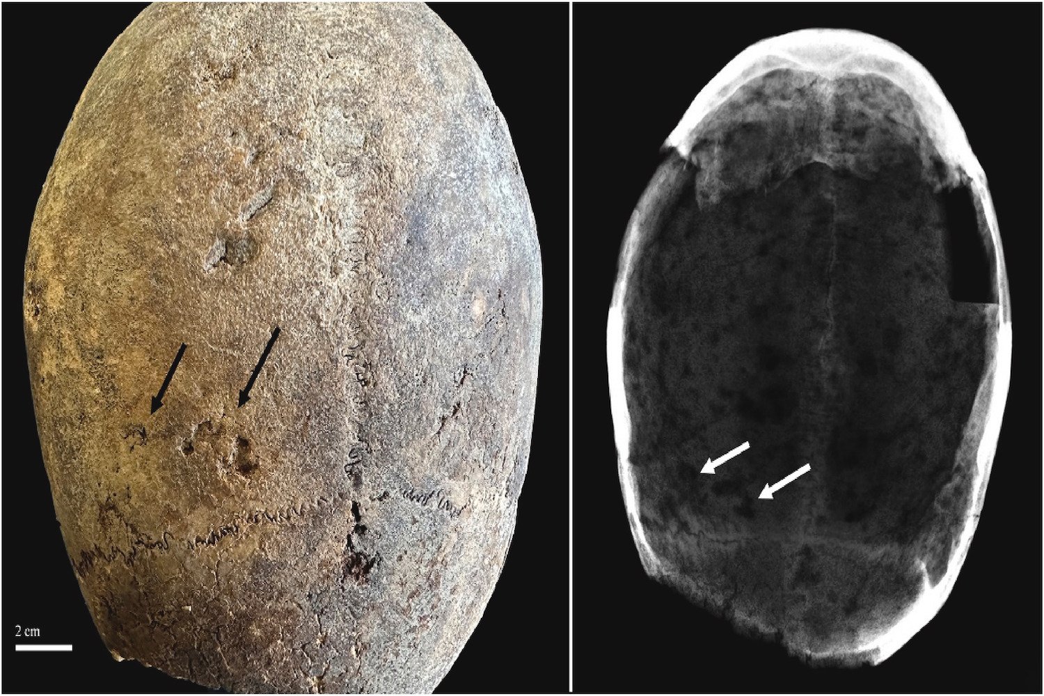 Photo of mummified cranium from 17th century Milan